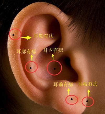 耳 痣|耳朵长痣的位置图解 耳朵长痣的位置图解有福气